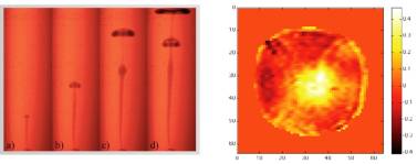 mantle4 mri image