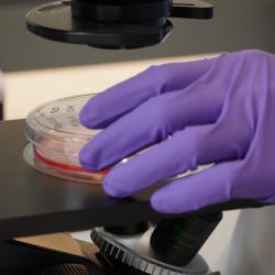 Purple gloved hand holding cancer cells under microscope.